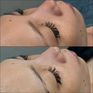 LiZA エステティックサロンのエステ・リラクイメージ