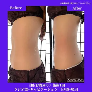 メンズ 有人型セルフサロン 脱毛/痩身/美顔のその他イメージ