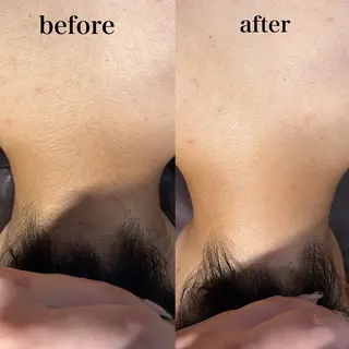 Mr.&Ms.脱毛 /眉毛/りかこのエステ・リラクイメージ