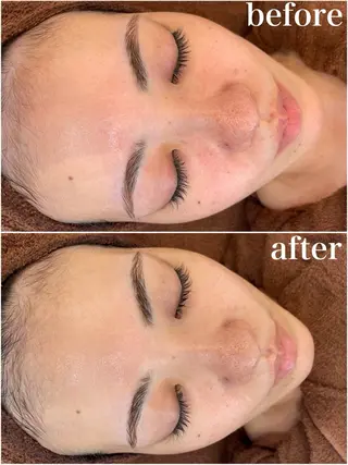 パーソナル肌質改善 🦋APRI🅿️有のエステ・リラクイメージ