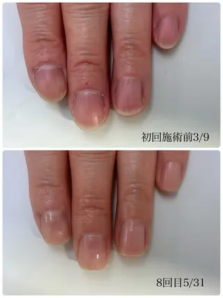 ネイル TiALASH ＊Kozue＊のネイルデザイン