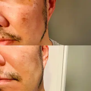 溝の口エステranan所属・化粧品成分研究/講師 ranan三浦のエステ・リラクイメージ