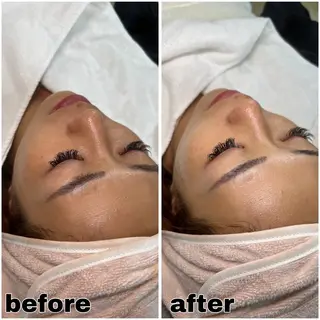 SHECIAお顔剃りシェービング専門店所属・お顔剃りエステサロン SHECIAのその他イメージ