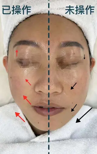 マツエク・マツパ aliaハイフ&水光ジェットサロン所属・aliaハーブ水光店 エステティシャン募集のエステ・リラクイメージ