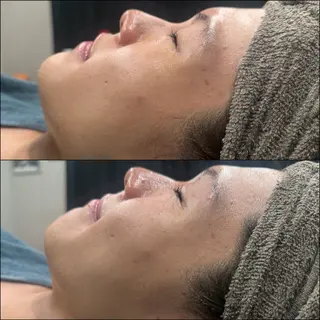 LiZA エステティックサロンのエステ・リラクイメージ