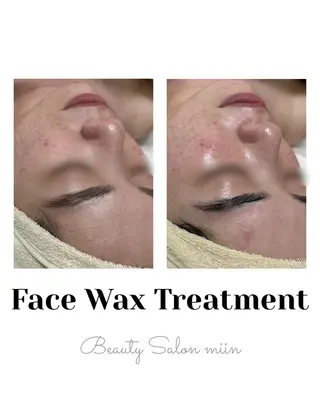 韓国肌管理 白玉肌管理®︎のエステ・リラクイメージ