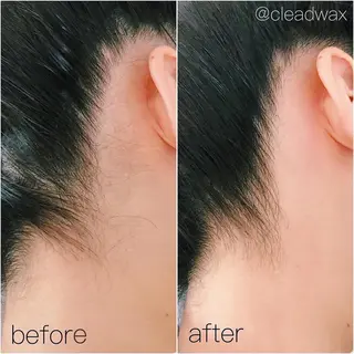 CLEAD 赤坂見附店のエステ・リラクイメージ