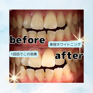 ホワイトニングサロン Soleilのその他イメージ