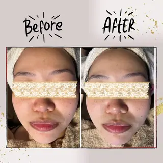 ピーリング専門店 Belluteのエステ・リラクイメージ