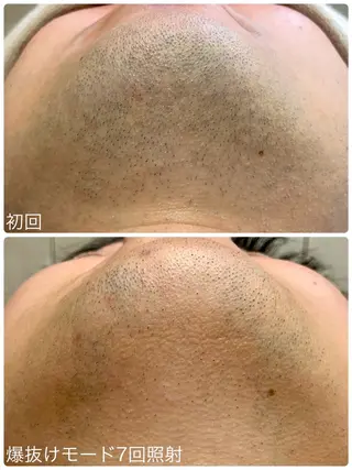 Hisui 小出のエステ・リラクイメージ