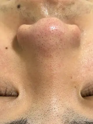 麻布十番エステサロン WhiteAzabuのエステ・リラクイメージ