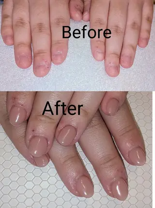 ネイル ネイリストゆか💅 長さだし、深爪矯正のネイルデザイン