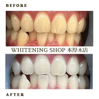 メンズ ホワイトニング ショップ本厚木のその他イメージ