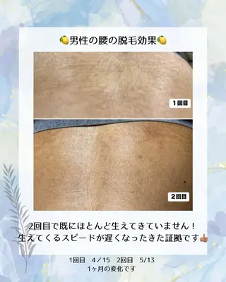 メンズ エステサロン lx (ルクス)所属・エステサロン lx(ルクス)のエステ・リラクイメージ