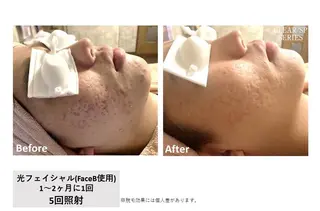 Clear尾張旭店 熊谷のエステ・リラクイメージ