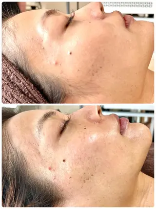 CHICIEL所属・枚方市香里園脱毛 サロンCHICIELのエステ・リラクイメージ