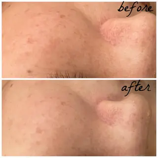 メンズ メナード岐阜市茜部 杉浦のエステ・リラクイメージ