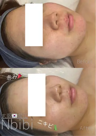 韓国🇰🇷価格 サロン_Nbibiのエステ・リラクイメージ