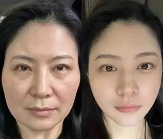 ネイル aliaハイフ&水光ジェットサロン所属・aliaハーブ水光店 エステティシャン募集のエステ・リラクイメージ