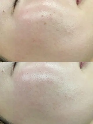 Melyssa🌿所属・Melyssa🌿 メリッサのエステ・リラクイメージ