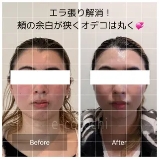 小顔と ヘッドスパのお店のエステ・リラクイメージ