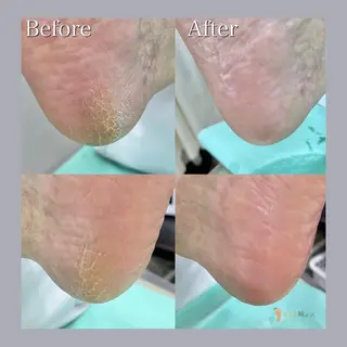 巻き爪補正店 大阪天王寺店のネイルデザイン