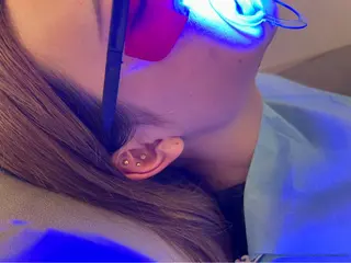 歯のセルフホワイトニング専門店GLOW(グロウ)所属・東区香椎歯のセルフホ ワイトニングGLOWのその他イメージ