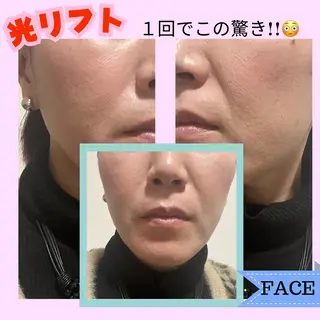 Adam 上半身美人のエステ・リラクイメージ