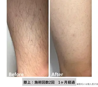 メンズ キッズ esperanza エスペランサのエステ・リラクイメージ