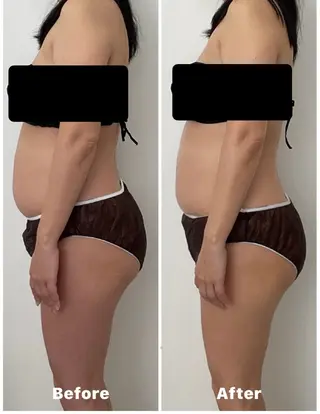 心と体が整う腸活 サロン ラクシュミーのその他イメージ