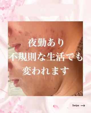 ニキビ跡専門サロン Ａｉｎａのエステ・リラクイメージ