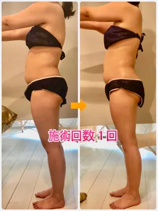 ショート カラー パーマ ヘアアレンジ メンズ キッズ ネイル マツエク・マツパ ‍痩身＆ボディ 結果出し🌟丹野のエステ・リラクイメージ