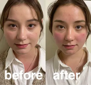 美容鍼灸サロン mahoroba院長のエステ・リラクイメージ