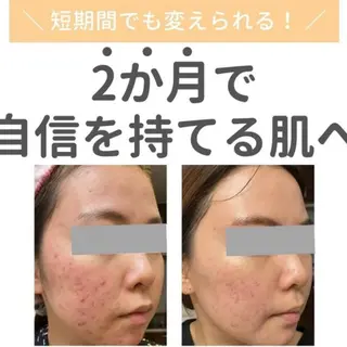 堀江リンパマッサージ 肩こり/リンパ/小顔のエステ・リラクイメージ