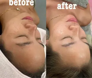 美容鍼灸サロン mahoroba院長のエステ・リラクイメージ