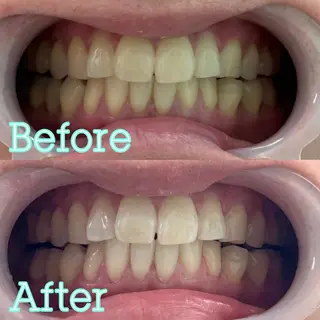 歯のホワイトニング専門店 MIGAQ 京都四条大宮店所属・佐藤 未来の眉毛・アイブロウイメージ