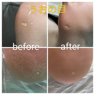 巻き爪補正店 大阪なんば店のネイルデザイン