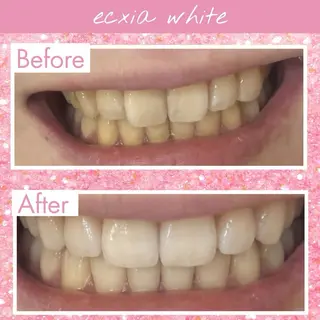 セルフホワイトニング エクシア大府店のその他イメージ