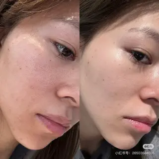 ショート aliaハイフ&水光ジェットサロン所属・aliaハーブ水光店 エステティシャン募集のエステ・リラクイメージ