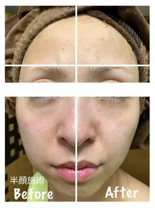 KalanDiva〜 ｶﾗﾝﾃﾞｨｰﾊﾞ〜のエステ・リラクイメージ