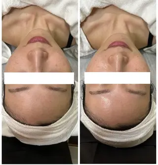 デ・アイム赤城所属・ナリス化粧品🌹 saoriのエステ・リラクイメージ