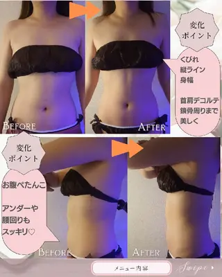 痩身ハーブピーリング 筋膜リリース☆B&Hのエステ・リラクイメージ