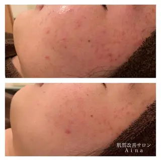 ミディアム カラー パーマ ヘアアレンジ メンズ キッズ ネイル マツエク・マツパ ニキビ跡専門サロン Ainaのエステ・リラクイメージ