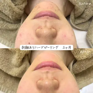 肌質改善サロン renew所属・肌質改善サロン renew/ｳｴｷのエステ・リラクイメージ