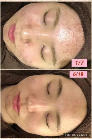 カラー パーマ ヘアアレンジ メンズ キッズ ネイル マツエク・マツパ 四つ星サロン🎖 腸＆ニキビケアに特化のエステ・リラクイメージ