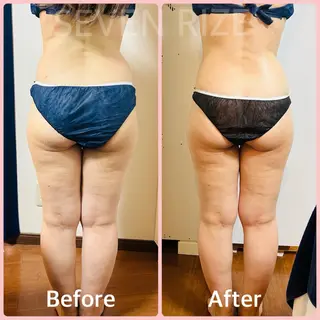 SevenRoom 玉置のエステ・リラクイメージ