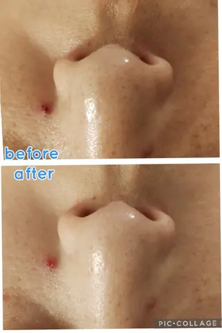 beauty salon    向日葵所属・beauty  salon 向日葵のエステ・リラクイメージ