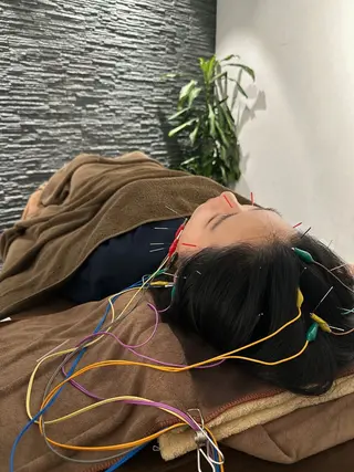 美容鍼灸整体サロンBeauJu所属・小顔矯/美容鍼/鍼灸 BeauJuのその他イメージ