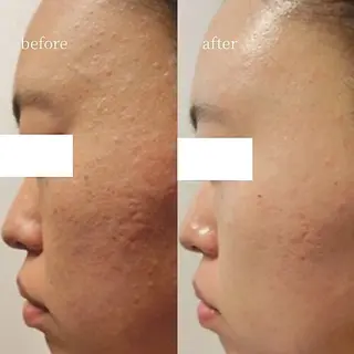 韓国肌管理・肌質改善 EARNEST心斎橋のエステ・リラクイメージ