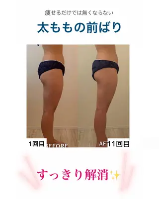 産後ダイエット−9㎏ Pourvous結衣のエステ・リラクイメージ